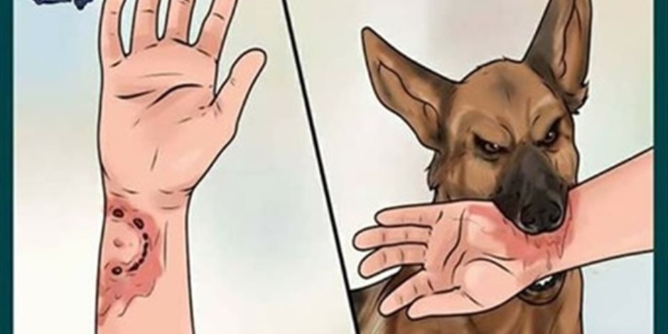 كيف تتعامل مع عضة الكلب ب6 علاجات منزلية طبيعية قبل المساعدة الطبية