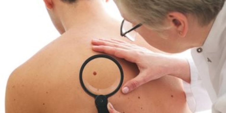 لماذا تحافظ لقاحات سرطان الجلد على استجابتها المناعية بالجسم بعد سنوات من الحقن؟