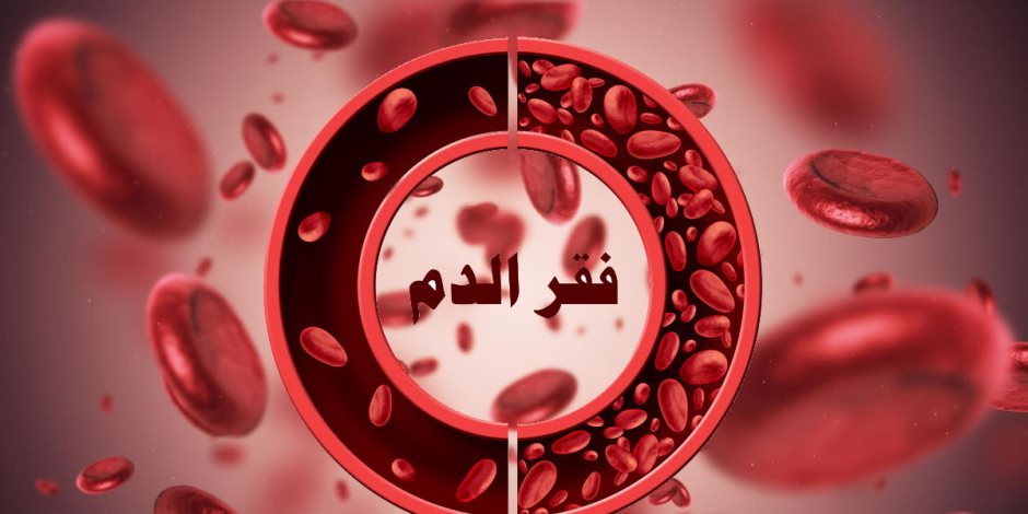 ما هي أعراض الإصابة بفقر الدم؟  الصحة تجيب