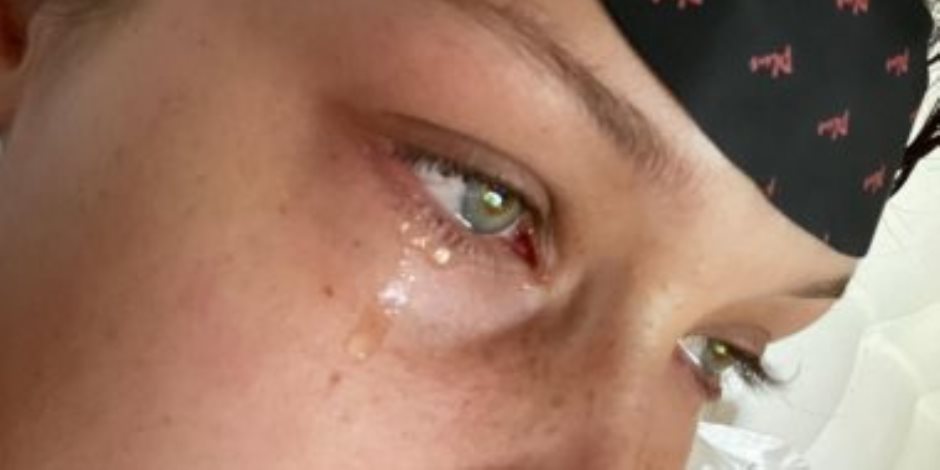 دموع بيلا حديد تكشف لحظاتها الصعبة (صور)