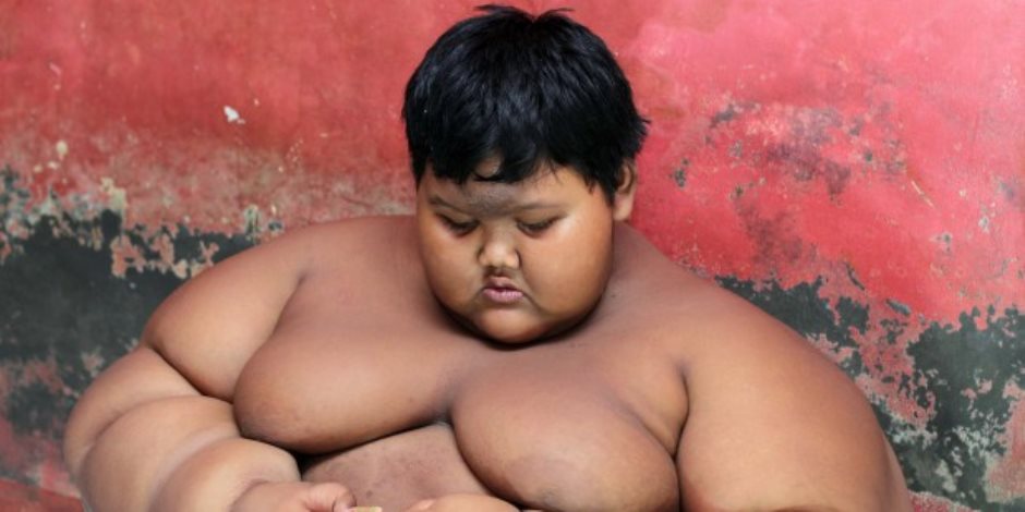 فى 4 سنوات.. أثقل طفل فى العالم يفقد 120 كيلو من وزنه