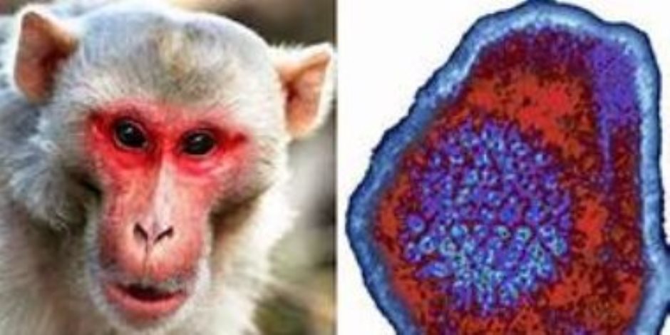 "ديلى ميل": اكتشاف أكثر من 200 إصابة بجدرى القرود فى 23 دولة