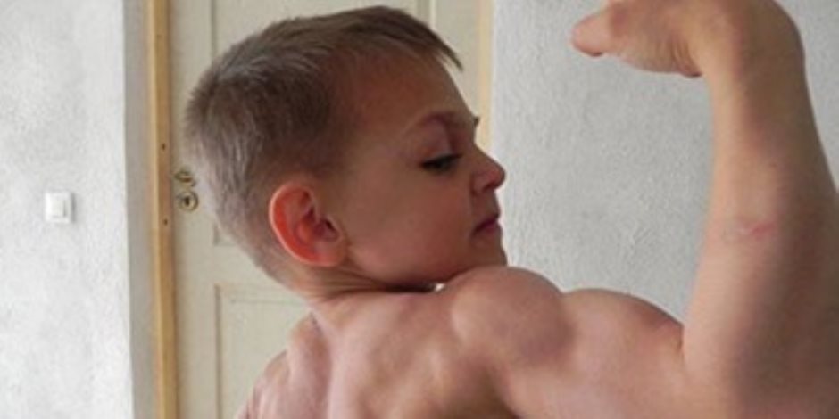 ما هي أنواع العلاجات المختلفة لمرض ضمور العضلات عند الأطفال ؟