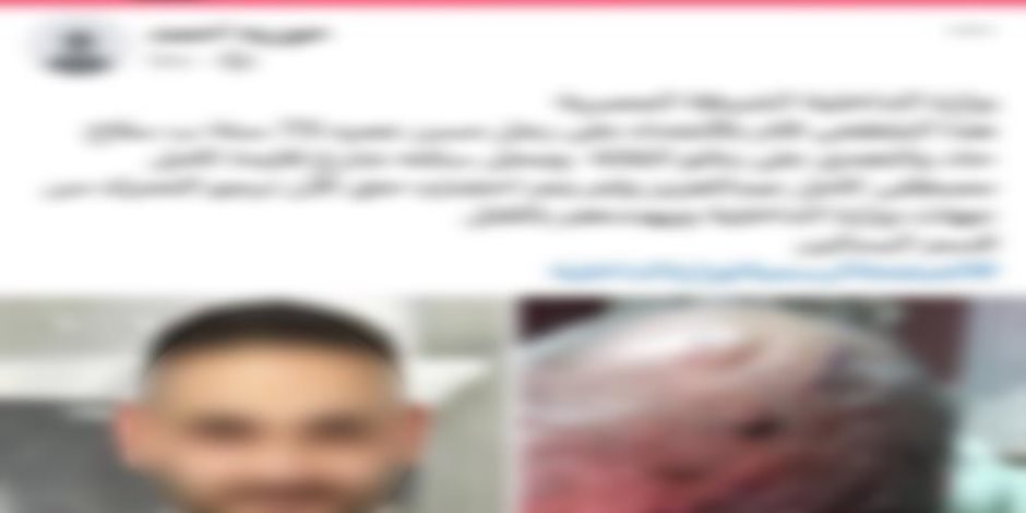 ضبط جزار لتعديه على رجل مسن بالضرب بسلاح أبيض فى القاهرة ضبط جزار لتعديه على رجل مسن بالضرب بسلاح أبيض فى القاهرة