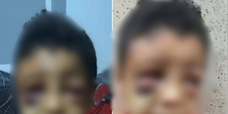 كشف ملابسات واقعة تعرض طفل للضرب وإحداث إصابته داخل إحدى المدارس بقنا