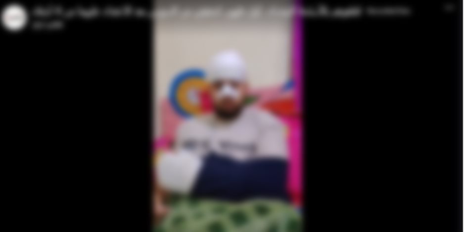 كشف ملابسات نشوب مشاجرة بين عدد من الأشخاص بالأسلحة البيضاء بالسويس