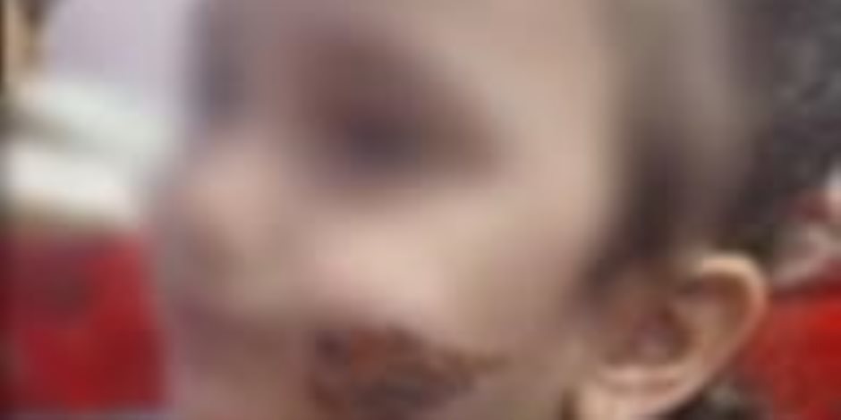 ضبط مرتكبة واقعة حرق ابنتها في كفر الشيخ