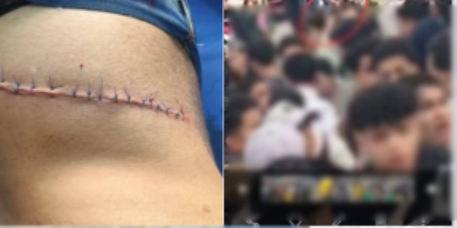 كشف ملابسات واقعة تعدٍ طالب على زميله بسلاح أبيض أمام مدرسة بالمنوفية