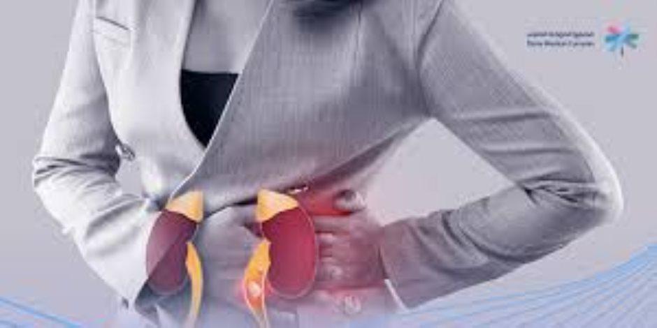 تلف الكلى المبكر لا تظهر له أعراض.. فحوصات يجب الخضوع لها