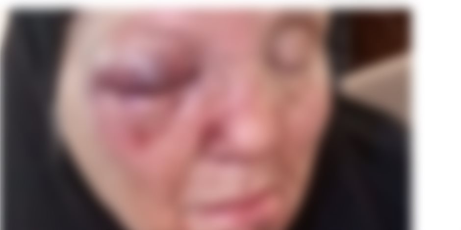 كشف ملابسات قيام أحد الأشخاص بالتعدي على والدته المسنة بالغربية