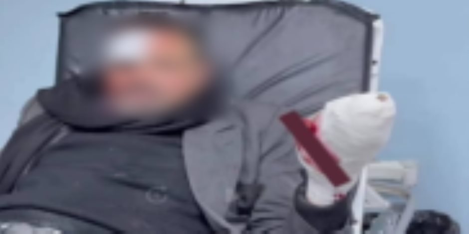 كشف ملابسات قيام شخص بالتعدي على آخر بالضرب وإحداث إصابته بسلاح أبيض بالقاهرة