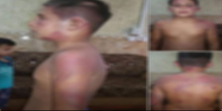 الداخلية: تعذيب طفل داخل دار رعاية أيتام واقعة قديمة حدثت في دولة عربية