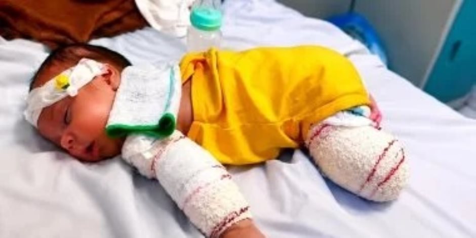 مأساة طفل فلسطيني .. الرضيع محمد الخطيب فقد أمه وبترت قدمه فى غارة إسرائيلية وينتظر فرصة العلاج خارج غزة