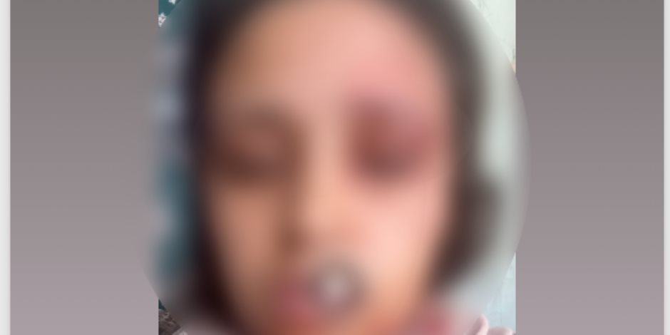 ضبط عامل بالشرقية لاعتدائه على زوجة شقيقه بالضرب داخل مسكنها
