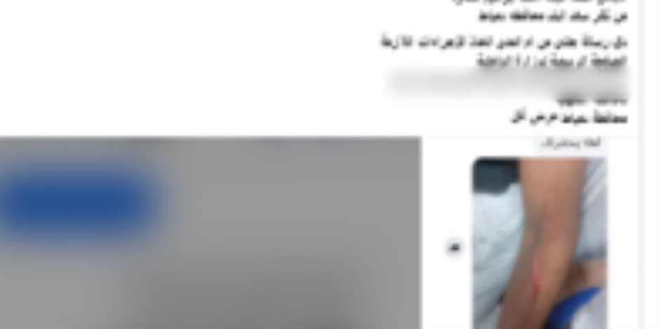 كشف ملابسات تضرر سيدة من تعدي طالب على نجلها بالضرب باستخدام سلاح أبيض وتهديدها