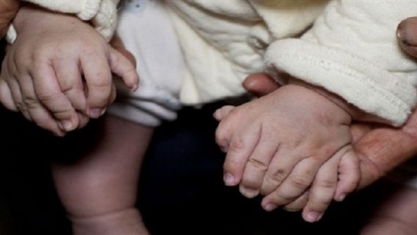ولادة طفل صيني بـ31 أصبعا 