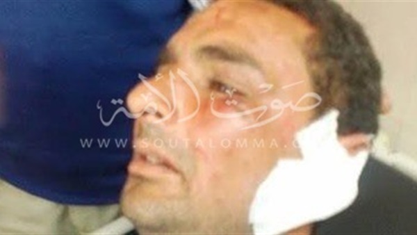 بالصور..20 غرزة لعامل «عضه» أمين شرطة في أُذنه ببورسعيد بالصور..20 غرزة لعامل «عضه» أمين شرطة في أُذنه ببورسعيد