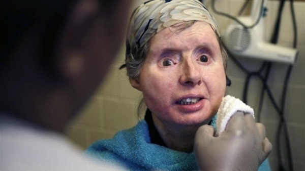 زرع فاشل لوجه ميتة لامرأة شوهها قرد