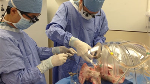 «إكس.بي.إس».. جهاز يجدد الرئة خارج الجسد قبل زرعها