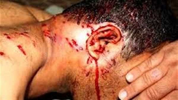 إصابة شخص بطلقات خرطوش بسبب لبن الأطفال إصابة شخص بطلقات خرطوش بسبب لبن الأطفال
