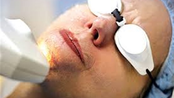 3 أسباب تؤدى لنمو الشعر أسفل الجلد