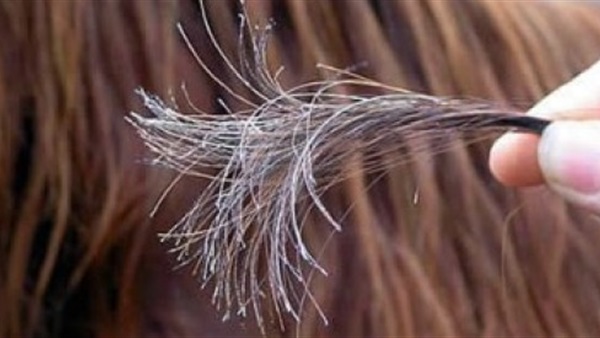 اليكى أفضل 6 وصفات طبيعية لعلاج تساقط الشعر 