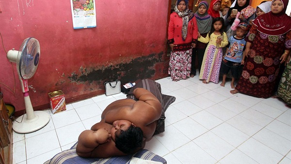 بالصور..طفل 10 أعوام ويزن 192 كجم