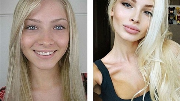 بالصور.. أشهر 7 جميلات روسيات تغير شكلهم بعد نفخ شفاهم 
