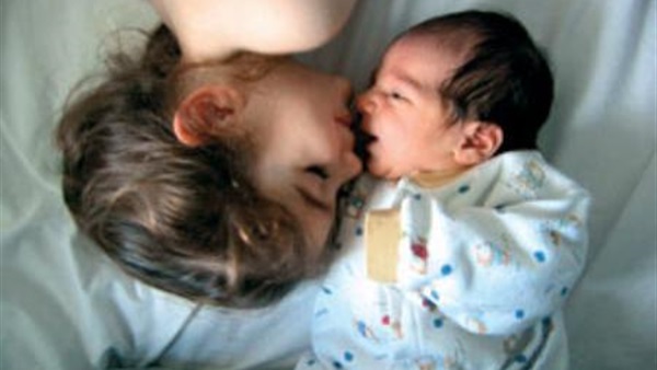 أول مولود أوروبي مصاب بضمور الجمجمة بسبب فيروس "زيكا"