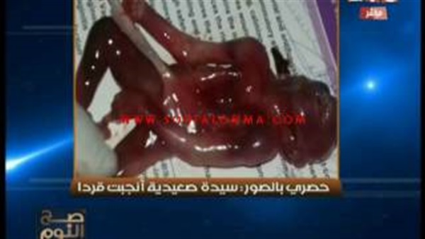 بالفيديو.. سيدة تنجب «قردًا» بصعيد مصر بالفيديو.. سيدة تنجب «قردًا» بصعيد مصر