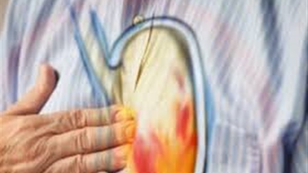 5 عادات خاطئة تؤدى إلى حموضة المعدة