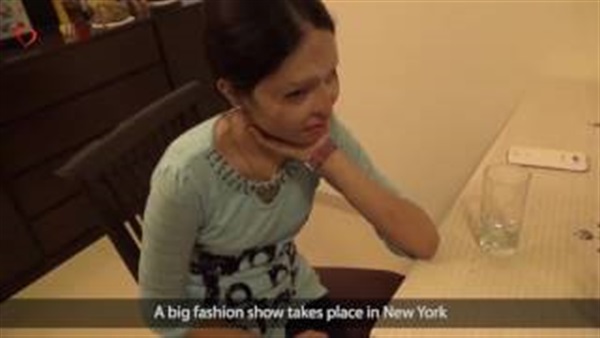 بالفيديو ..اختيار  فتاة مشوهة بـ«مية نار» للمشاركة فى عرض أزياء عالمي