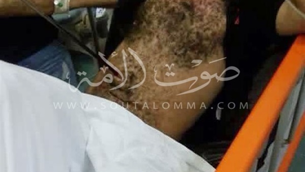 كبابجى يطعن عامل بـ «سيخ كفتة» فى الأميرية كبابجى يطعن عامل بـ «سيخ كفتة» فى الأميرية