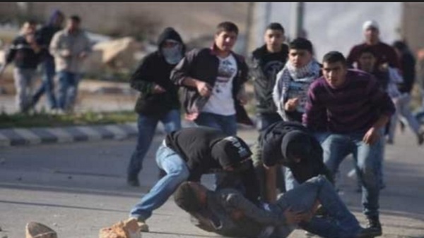 إصابة فلسطيني بجروح خطيرة برصاص الاحتلال في القدس إصابة فلسطيني بجروح خطيرة برصاص الاحتلال في القدس