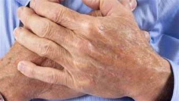 حمية "اليو يو" الغذائية تزيد من خطر الإصابة بأمراض القلب