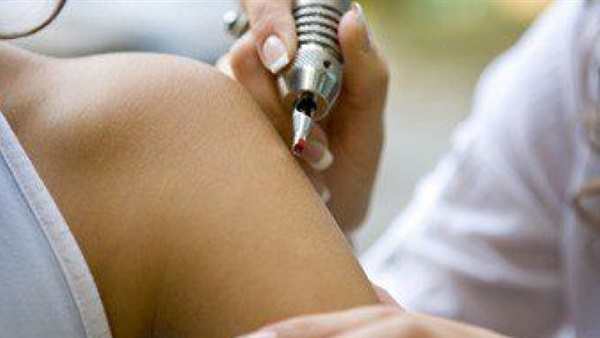 طبيبة جلدية تحذر من التاتو: الأحبار المستخدمة لدق الوشم مسرطنة