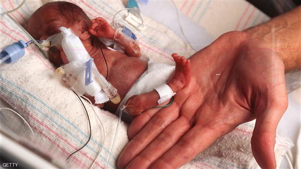 إليزابيث.. مولودة وزنها 500 جرام تعانق الحياة