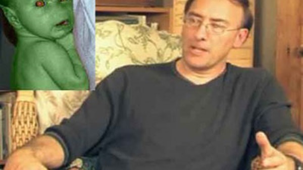 بريطانيا توافق على إجراء تلقيح ينجب طفل من 3 أشخاص