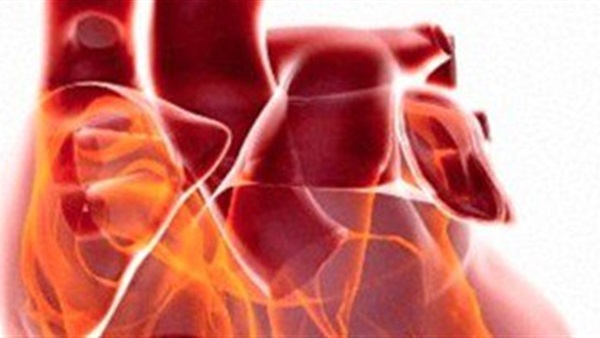 نصر: تناول المضادات الحيوية يخفض الإصابة بروماتيزم القلب