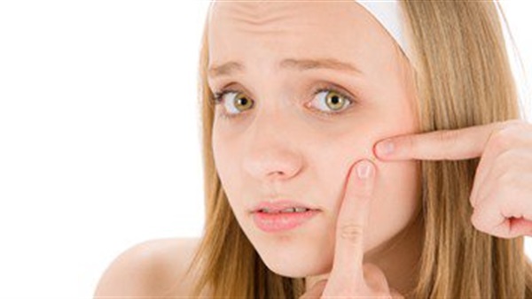 الإجهاد يتسبب في ظهور حب الشباب