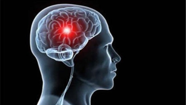 دراسة: فقد الإنسان لعزيز عليه قد يعرضه لخطر السكتات الدماغية