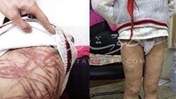 بالصور.. محاكمة أم بسبب جلدها لإبنها بطريقة وحشية بالصور.. محاكمة أم بسبب جلدها لإبنها بطريقة وحشية