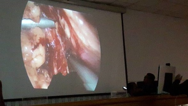 نقل عمليات جراحية بـ«الفيديو كونفرانس» بالمؤتمر السنوي لأمراض القلب