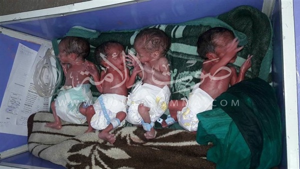 سيدة تنجب 4 توأم في مستشفى الأقصر الدولي سيدة تنجب 4 توأم في مستشفى الأقصر الدولي