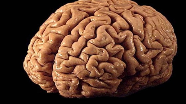دراسة: حجم المخ يؤثر على قوة الانتباه