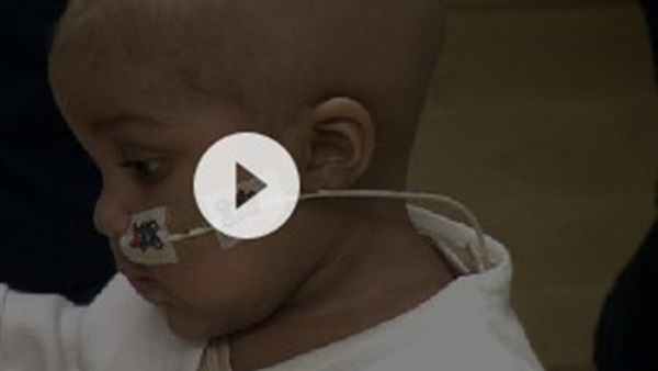 بالفيديو..طفرة فى علاج سرطان الدم عن طريق «خلايا مناعية معدلة» بالفيديو..طفرة فى علاج سرطان الدم عن طريق «خلايا مناعية معدلة»