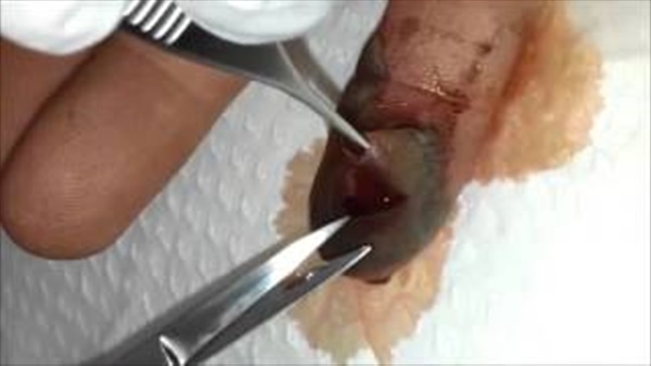  بالفيديو.. شاهد ماذا حدث ليد صياد أفاعى 