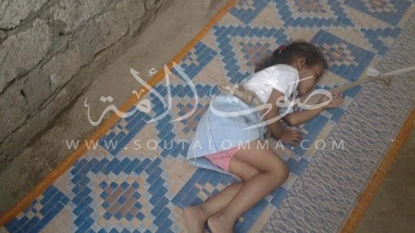 بالصور.. أسرة تعذب طفلتها فى «كوم أمبو» بسبب مرضها