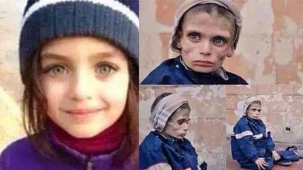 بالفيديو والصور.. الشعب السوري تحت قبضة «الجوع والسقيع».. 10 أشخاص يلقون بحتفهم يوميًا.. « لحوم القطط والكلاب والحمير» الوجبة الأساسية.. «إغاثة جوعى العالم» الألمانية تحذر من أزمة المجاعة بالفيديو والصور.. الشعب السوري تحت قبضة «الجوع والسقيع».. 10 أشخاص يلقون بحتفهم يوميًا.. « لحوم القطط والكلاب والحمير» الوجبة الأساسية.. «إغاثة جوعى العالم» الألمانية تحذر من أزمة المجاعة