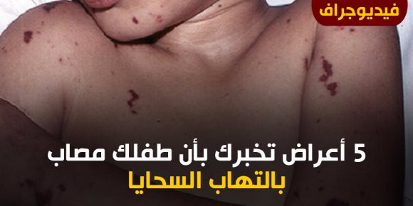 5 أعراض تخبرك بأن طفلك مصاب بالتهاب السحايا.. منهم الحمى والطفح الجلدى (فيديوجراف)